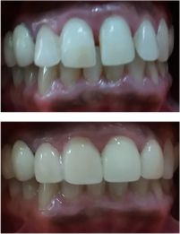 cosmetic-dentistry-image3