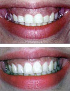 cosmetic-dentistry-image4
