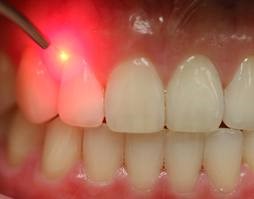 periodontal-2